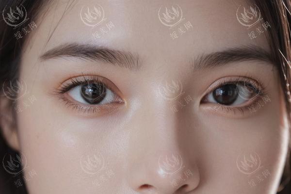 更新广州美恩医疗美容整形有限公司 价格表揭秘 丰唇1800+ 材料安全可查