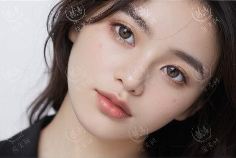冬季吃什么食物能美白？适合冬天的美白食材