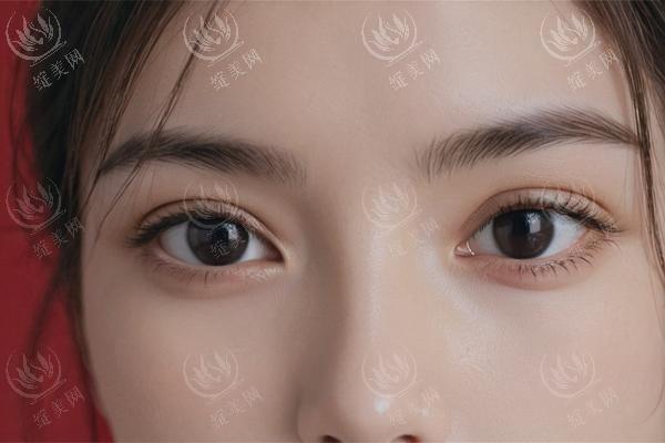 预防妊娠纹和祛妊娠纹哪个重要？提前准备工作要做好