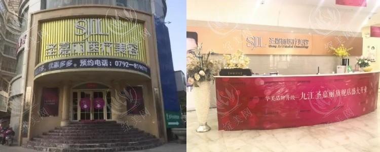 九江圣嘉丽医疗消费透明吗？无隐形收费，口碑佳，不同预算都合适​