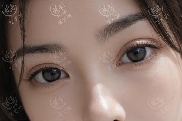 冰点脱毛适合私密部位吗？优势和劣势分析