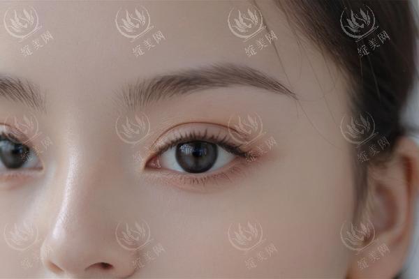 热玛吉做一次能维持多久？治疗深度与年龄的关系解析