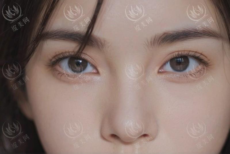 杭州美莱医疗美容医院 